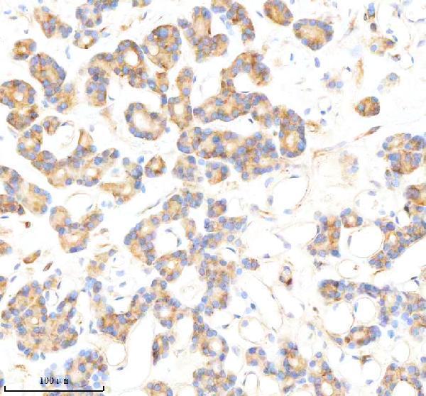 m00825 ldha primary antibodies ihc testing 2