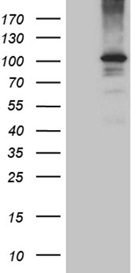 HEK293T cells were transfected with the pCMV6-ENTRY control (Left lane) or pCMV6-ENTRY EIF2C1 (Right lane) cDNA for 48 hrs and lysed