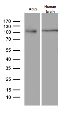 Western blot analysis of extracts (35ug) from K562 cell line and human brain tissue lysate by using anti-EIF2C1 monoclonal antibody (1:500)