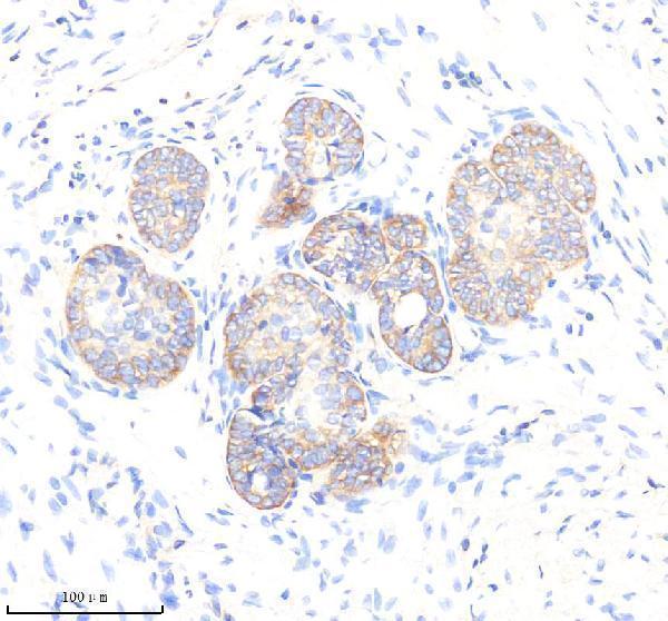  IHC analysis of EEF2 using anti-EEF2 antibody (M00830-1)