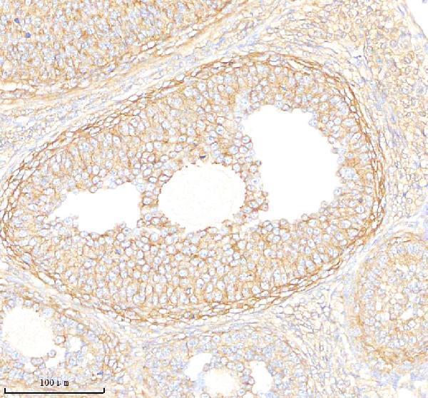 m00830 1 eef2 primary antibodies ihc testing 4