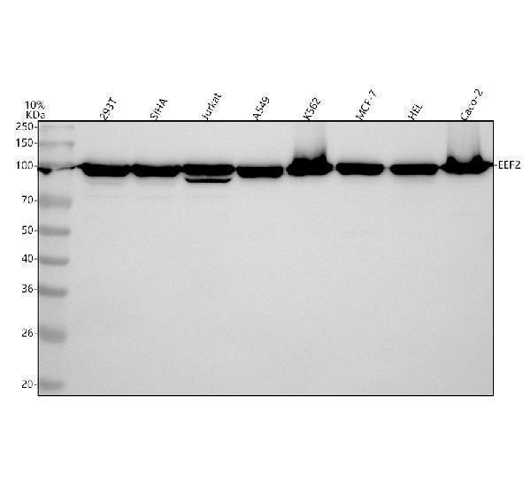  Western blot analysis of EEF2 using anti-EEF2 antibody (M00830-1)