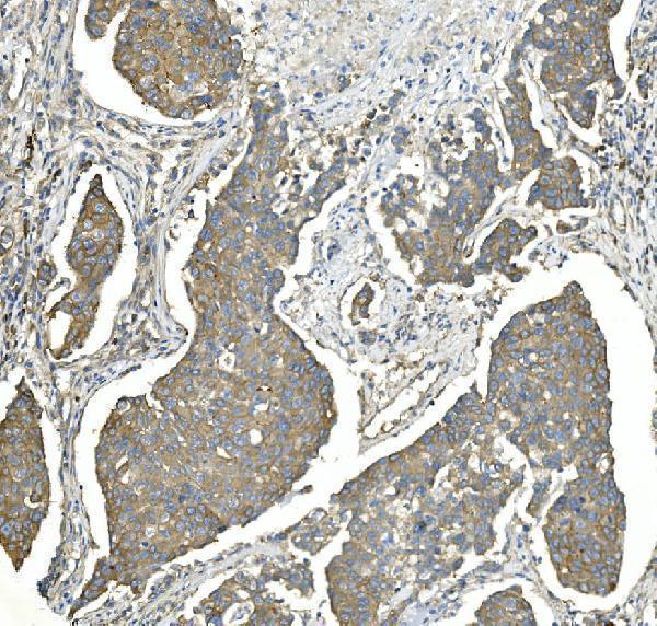 m00830 2 eef2 primary antibodies ihc testing 2