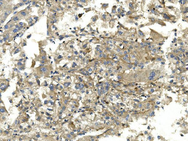m00830 2 eef2 primary antibodies ihc testing 4