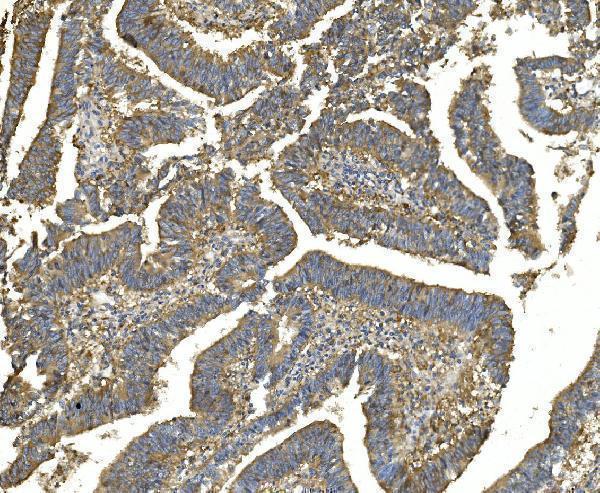m00830 2 eef2 primary antibodies ihc testing 5