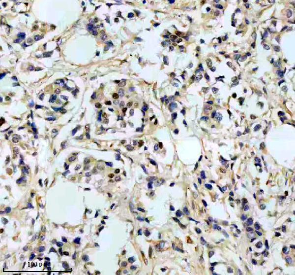 IHC analysis of TIMELESS using anti-TIMELESS antibody (M00831)