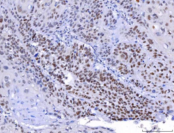  IHC analysis of YY1 using anti-YY1 antibody (M00833-1)