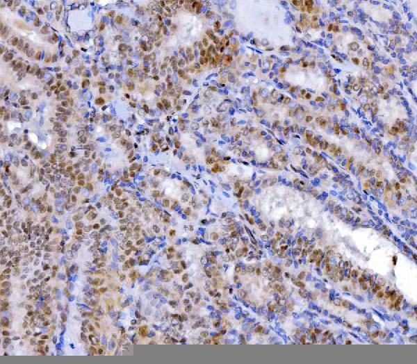  IHC analysis of YY1 using anti-YY1 antibody (M00833-2)