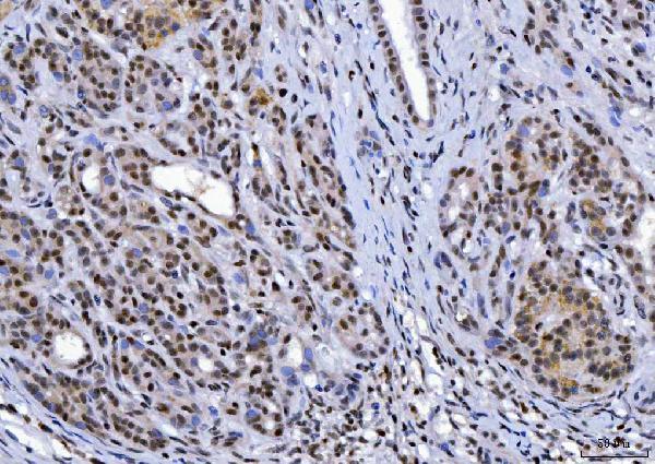  IHC analysis of YY1 using anti-YY1 antibody (M00833-2)