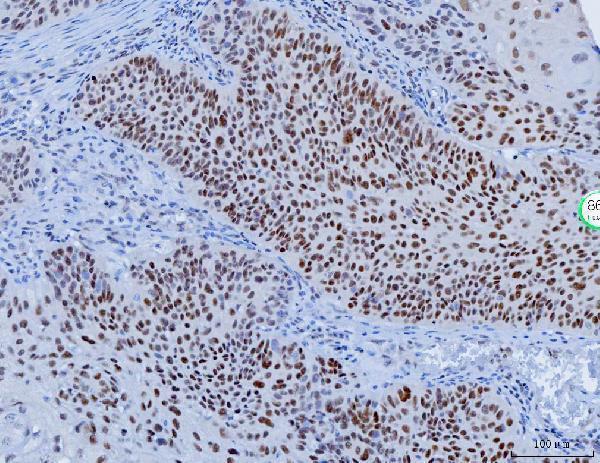 m00833 2 yy1 primary antibodies ihc testing 4