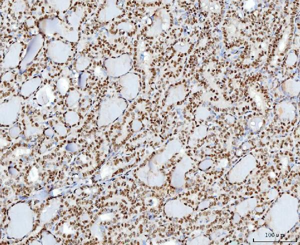  IHC analysis of YY1 using anti-YY1 antibody (M00833-3)