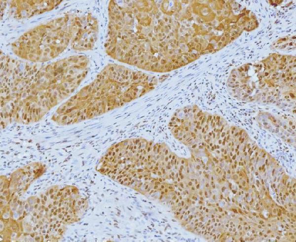  IHC analysis of YY1 using anti-YY1 antibody (M00833-3)