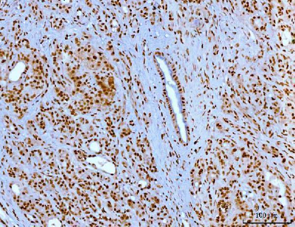 m00833 3 yy1 primary antibodies ihc testing 5