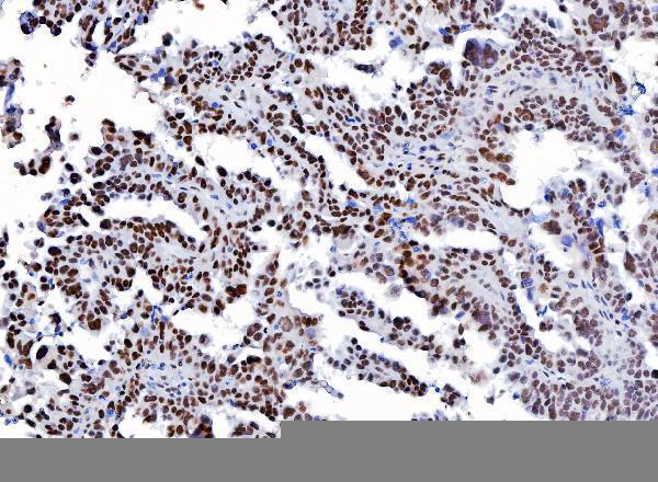 m00833 3 yy1 primary antibodies ihc testing 6