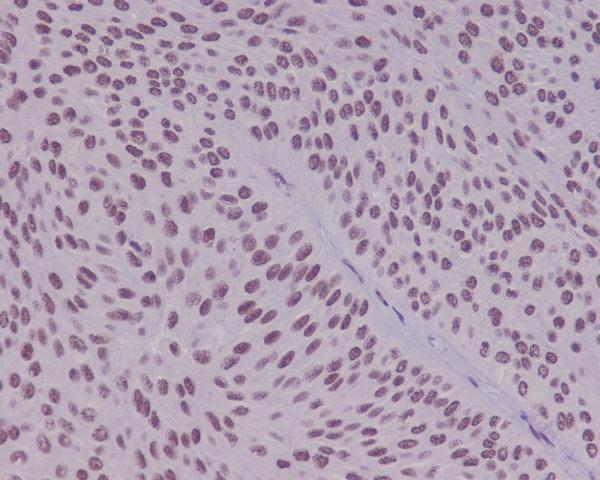Immunohistochemical analysis of paraffin-embedded human bladder using YY1 Antibody