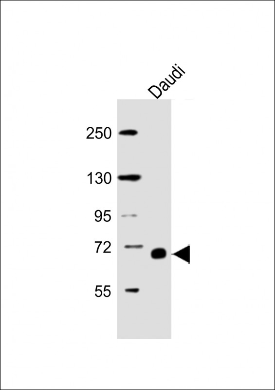 Anti-RELB Antibody at 1:5000 dilution + Daudi whole cell lysateLysates/proteins at 20 µg per lane