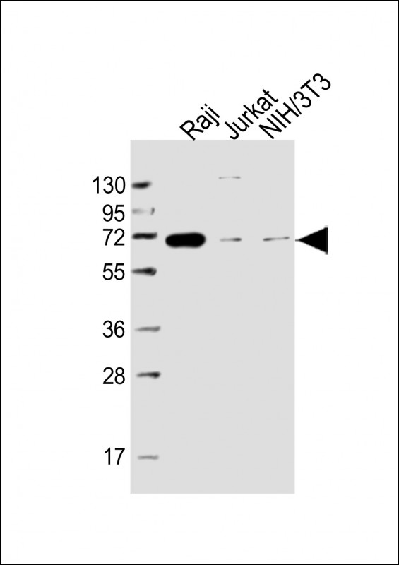 All lanes : Anti-RELB Antibody at 1:5000 dilutionLane 1: Raji whole cell lysateLane 2: Jurkat whole cell lysateLane 3: NIH/3T3 whole cell lysateLysates/proteins at 20 µg per lane