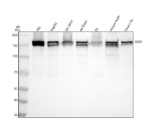 Western blot analysis of SOS1 using anti-SOS1 antibody (M00837)