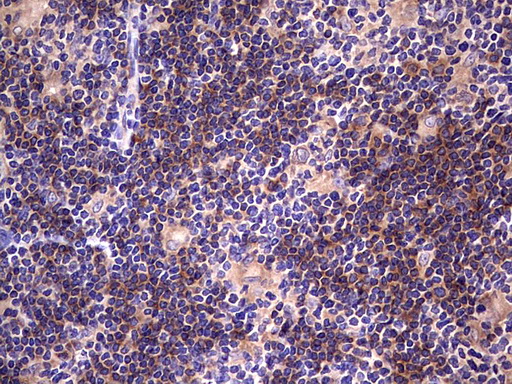 m00840 1 anti dot1l mouse monoclonal antibody clone id oti1d8 ihc testing 2