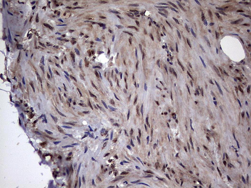 m00840 1 anti dot1l mouse monoclonal antibody clone id oti1d8 ihc testing 3