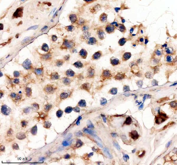 m00840 dot1l primary antibodies ihc testing 1
