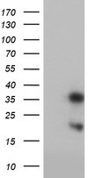HEK293T cells were transfected with the pCMV6-ENTRY control (Left lane) or pCMV6-ENTRY FXN (Right lane) cDNA for 48 hrs and lysed