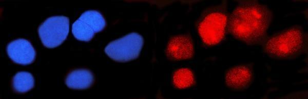  IF analysis of IFI16 using anti-IFI16 antibody (M00848)