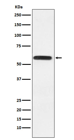 Western blot analysis of Lgi1 expression in HeLa cell lysate