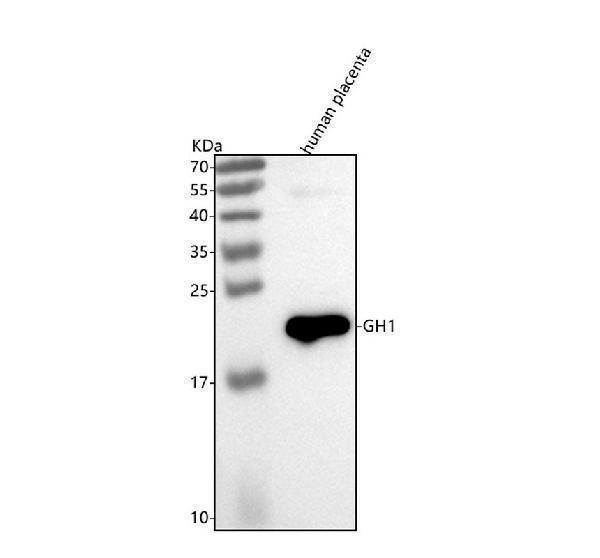  Western blot analysis of GH1 using anti-GH1 antibody (M00851-1)