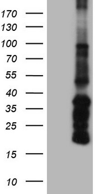 Human recombinant protein fragment corresponding to amino acids 198-498 of human ANGPT1 (NP_001137) produced in E