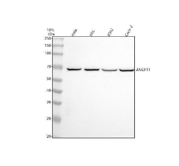  Western blot analysis of Angiopoietin-1/ANGPT1 using anti-Angiopoietin-1/ANGPT1 antibody (M00853)