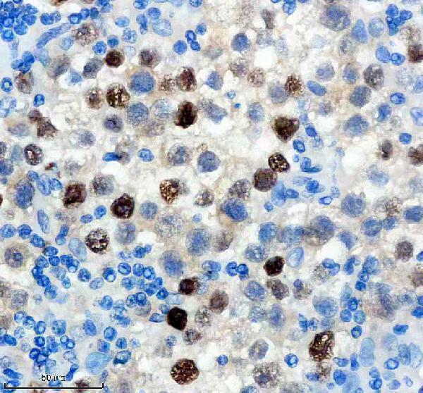 m00856 ncoa1 primary antibodies ihc testing 1