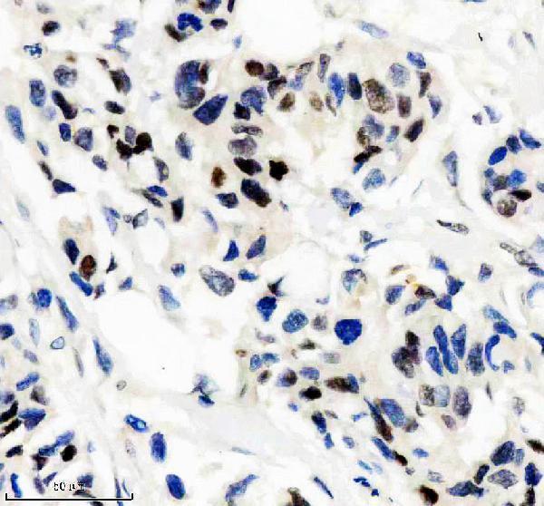 m00856 ncoa1 primary antibodies ihc testing 2