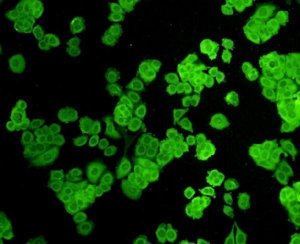 ICC staining ZO1 in MCF-7 cells (green)