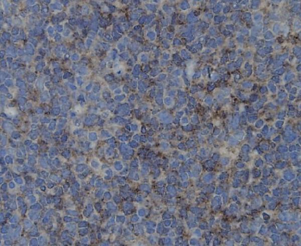Immunohistochemical analysis of paraffin-embedded human tonsil tissue using anti-ZO1 antibody