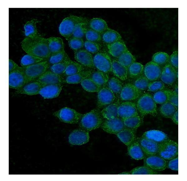 m00860 tjp1 primary antibodies if testing 5_1