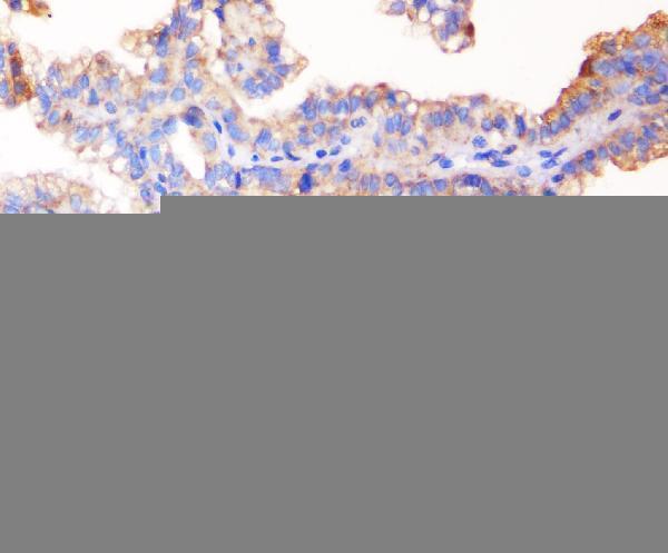 m00860 zo 1 primary antibodies ihc testing 3