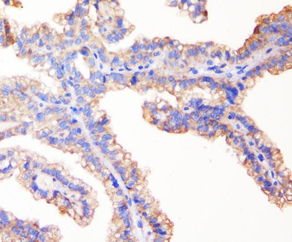 m00860 zo 1 primary antibodies ihc testing 3_1