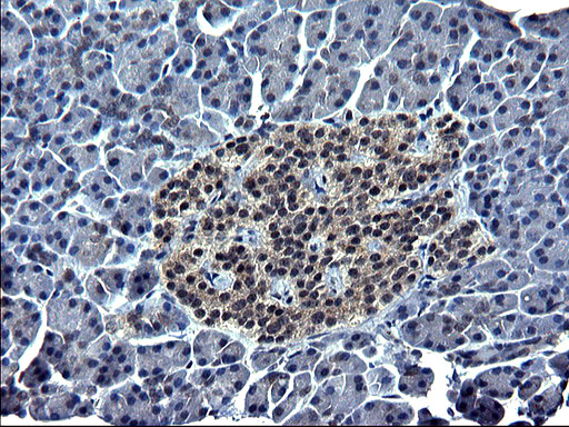 m00862 anti sparc mouse monoclonal antibody clone id oti2b1 ihc testing 2
