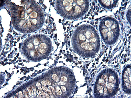 m00862 anti sparc mouse monoclonal antibody clone id oti2b1 ihc testing 3