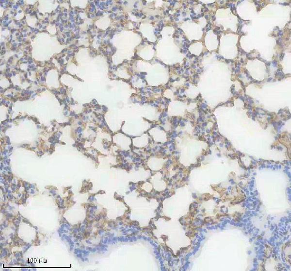 IHC analysis of AQP1 using anti-AQP1 antibody (M00865)