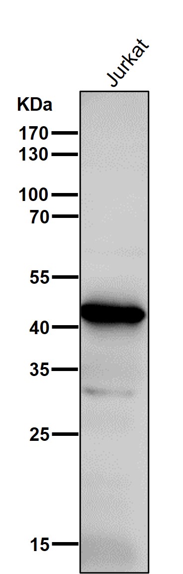 All lanes use the Antibody at 1:1K dilution for 1 hour at room temperature