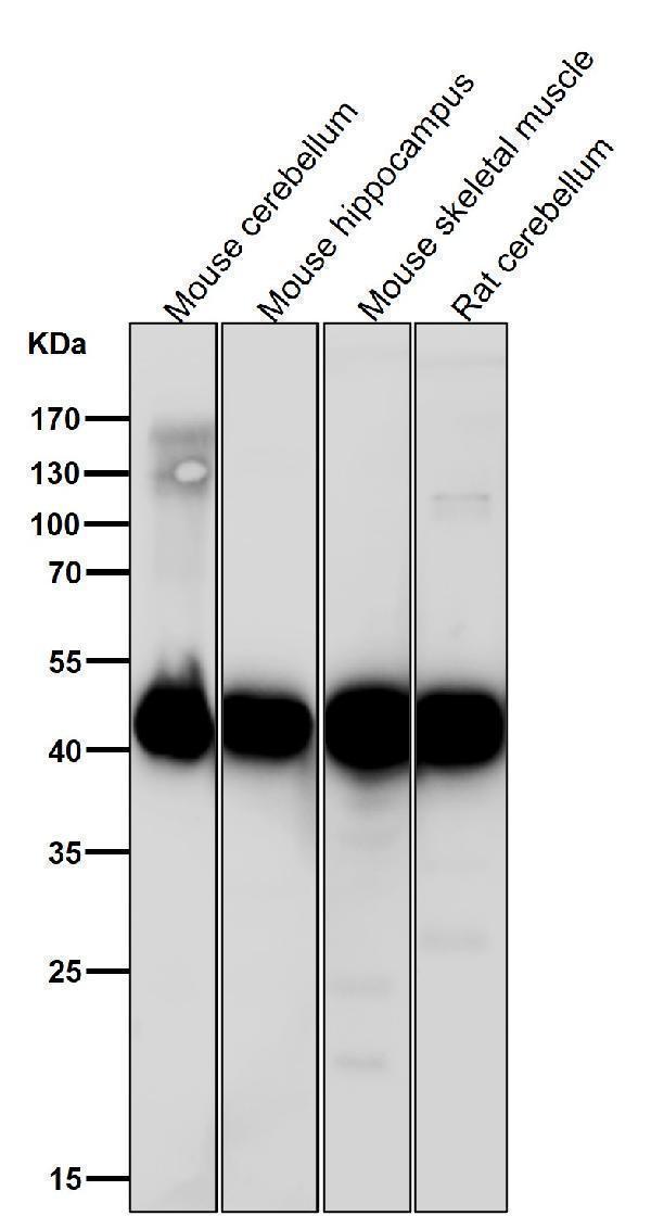 All lanes use the Antibody at 1:1K dilution for 1 hour at room temperature