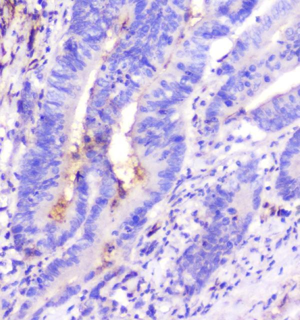 m00866 ada primary antibodies ihc testing 4