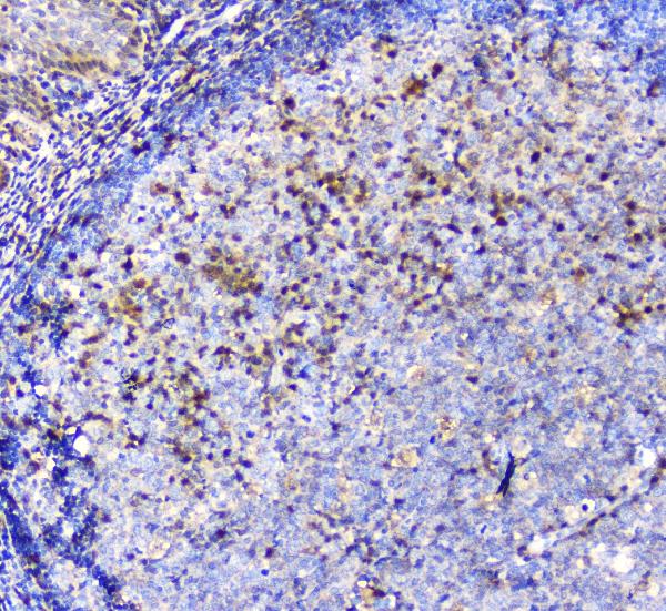 IHC analysis of ADA using anti-ADA antibody (M00866). ADA was detected in paraffin-embedded section of human tonsil tissue. Heat mediated antigen retrieval was performed in citrate buffer (pH6, epitope retrieval solution) for 20 mins. The tissue section was blocked with 10% goat serum. The tissue section was then incubated with 1μg/ml mouse anti-ADA Antibody (M00866) overnight at 4°C. Biotinylated goat anti-mouse IgG was used as secondary antibody and incubated for 30 minutes at 37°C. The tissue section was developed using Strepavidin-Biotin-Complex (SABC)(Catalog # SA1021) with DAB as the chromogen.