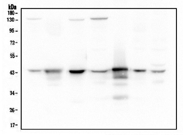 Western blot analysis of ADA using anti-ADA antibody (M00866). Electrophoresis was performed on a 5-20% SDS-PAGE gel at 70V (Stacking gel) / 90V (Resolving gel) for 2-3 hours. The sample well of each lane was loaded with 50ug of sample under reducing conditions. Lane 1: human Hela whole cell lysates, Lane 2: human placenta tissue lysates, Lane 3: human A549 whole cell lysates, Lane 4: human MCF-7 whole cell lysates, Lane 5: human U-937 whole cell lysates, Lane 6: human U20S whole cell lysates, Lane 7: human Caco-2 whole cell lysates. After Electrophoresis, proteins were transferred to a Nitrocellulose membrane at 150mA for 50-90 minutes. Blocked the membrane with 5% Non-fat Milk/ TBS for 1.5 hour at RT. The membrane was incubated with mouse anti-ADA antigen affinity purified monoclonal antibody (Catalog # M00866) at 0.5 μg/mL overnight at 4°C, then washed with TBS-0.1%Tween 3 times with 5 minutes each and probed with a goat anti-mouse IgG-HRP secondary antibody at a dilution of 1:10000 for 1.5 hour at RT. The signal is developed using an Enhanced Chemiluminescent detection (ECL) kit (Catalog # EK1001) with Tanon 5200 system.