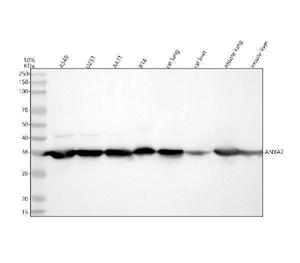 Western blot analysis of ANXA2 using anti-ANXA2 antibody (M00868)