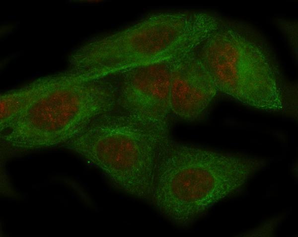 m00869 adar primary antibodies if testing 2