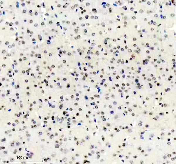 m00869 adar1 primary antibodies ihc testing 1