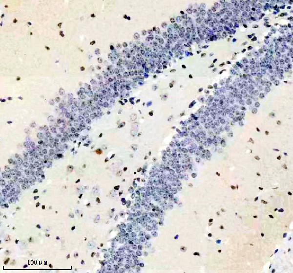 m00869 adar1 primary antibodies ihc testing 2